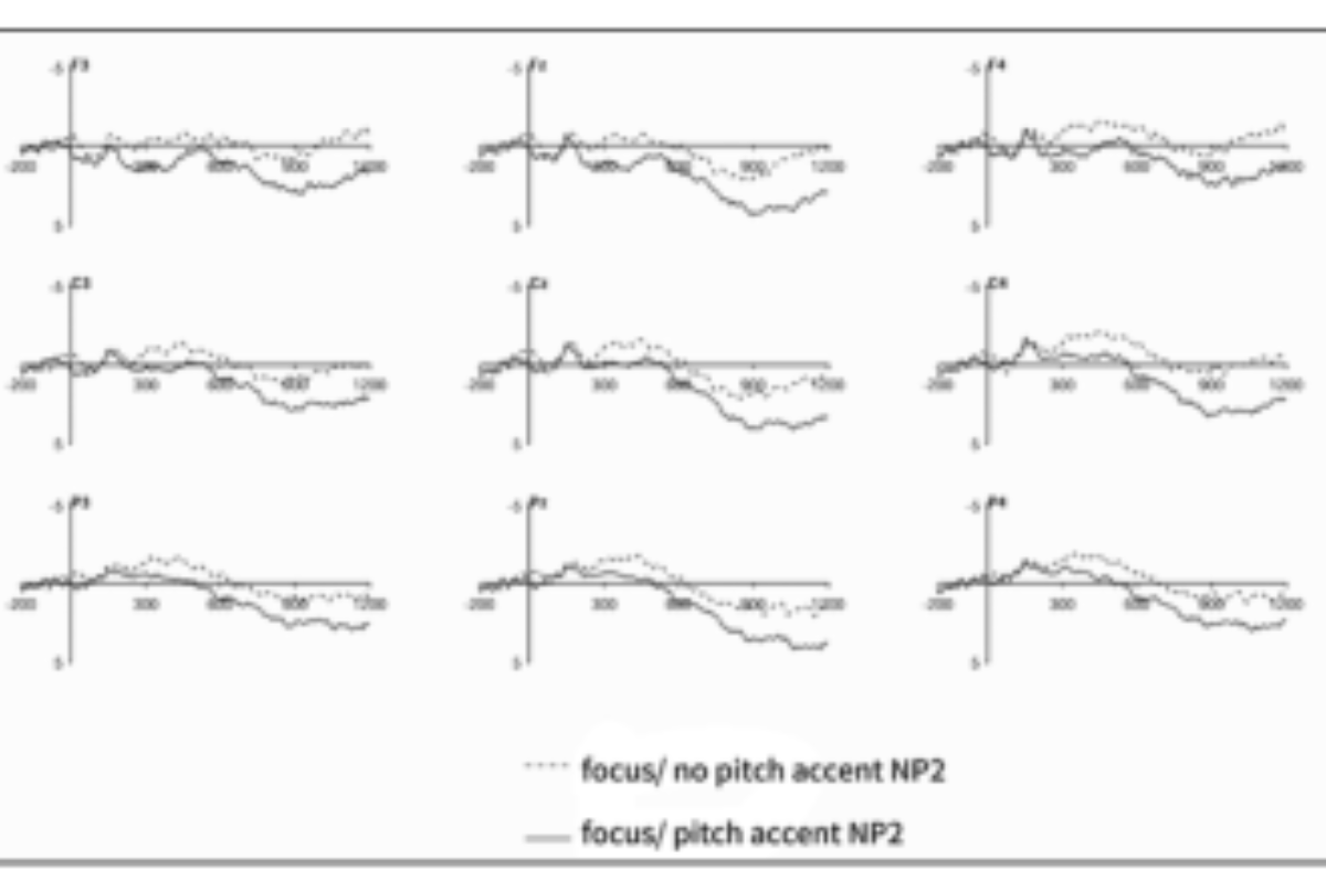 原论文 Figure 3:ERP waveforms for missing accent condition