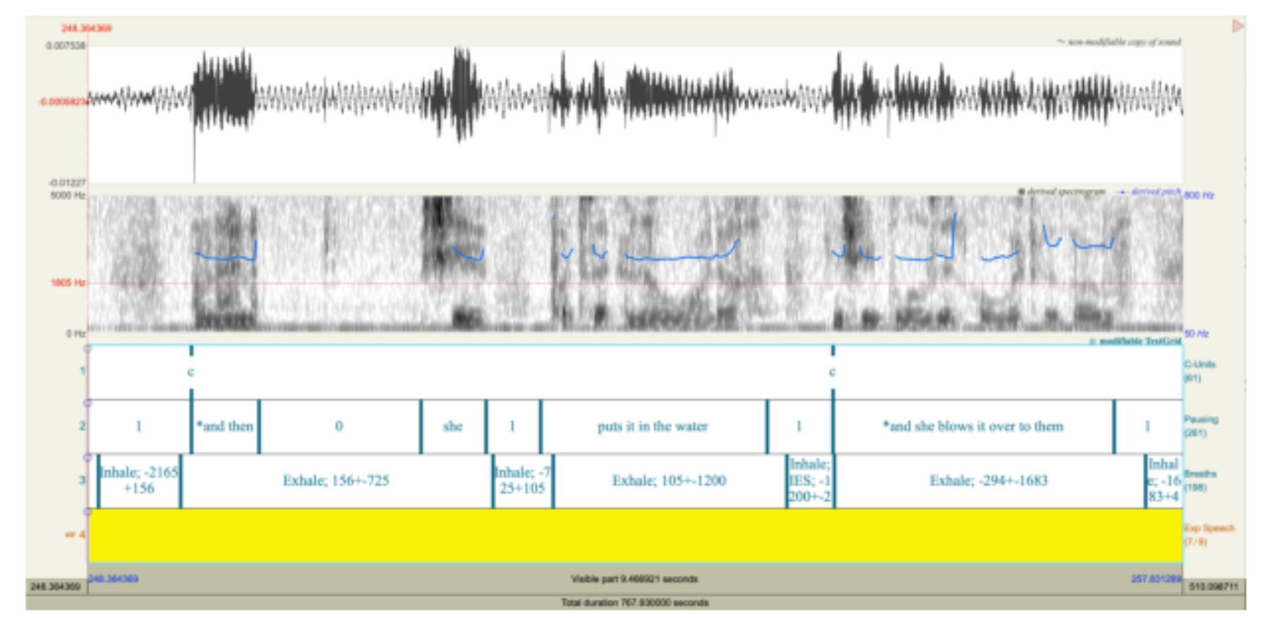 原论文 Figure 1:Speech acoustic and breathing waveforms were independently segmented into pause-delimited…