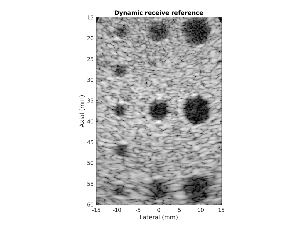 Dynamic receive reference image