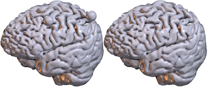 Influence of l 0 vs l 1