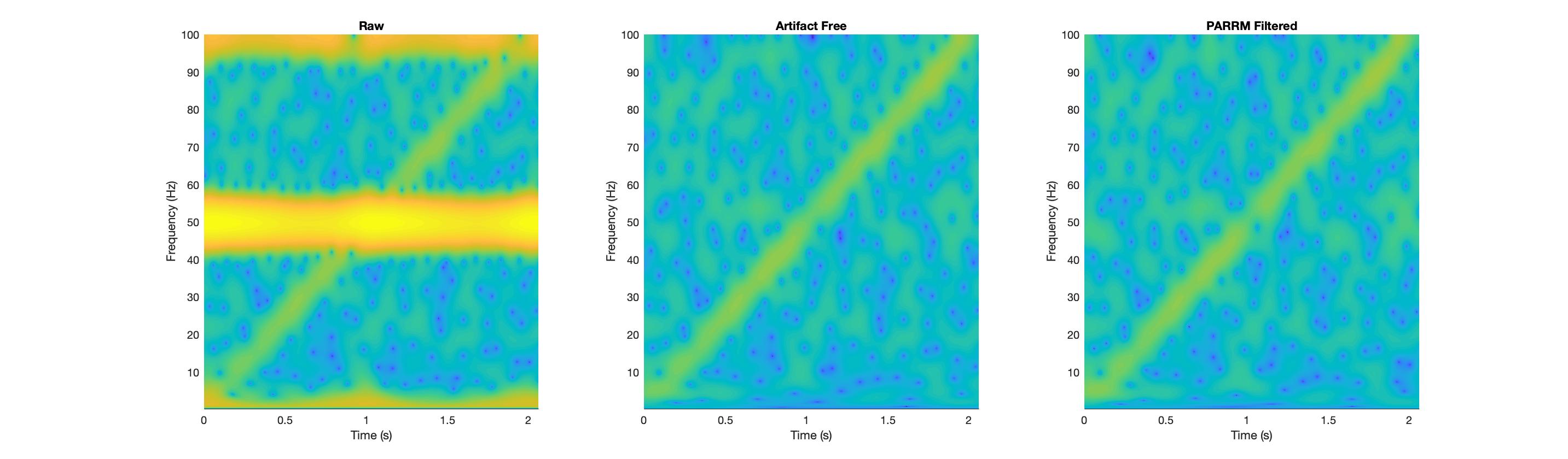 Frequency Domain PARRM