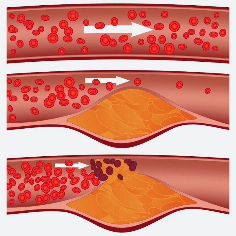 Tác dụng của rau muống giúp giảm cholesterol trong máu