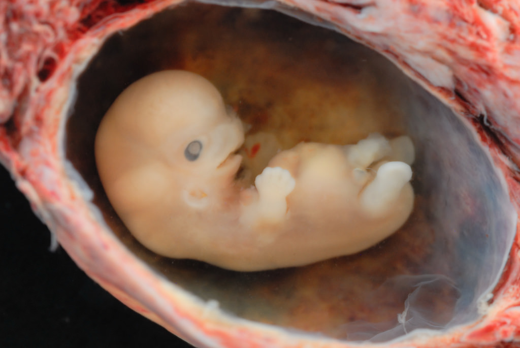 Quá trình thai vào tử cung có thể nhanh chậm tùy từng người