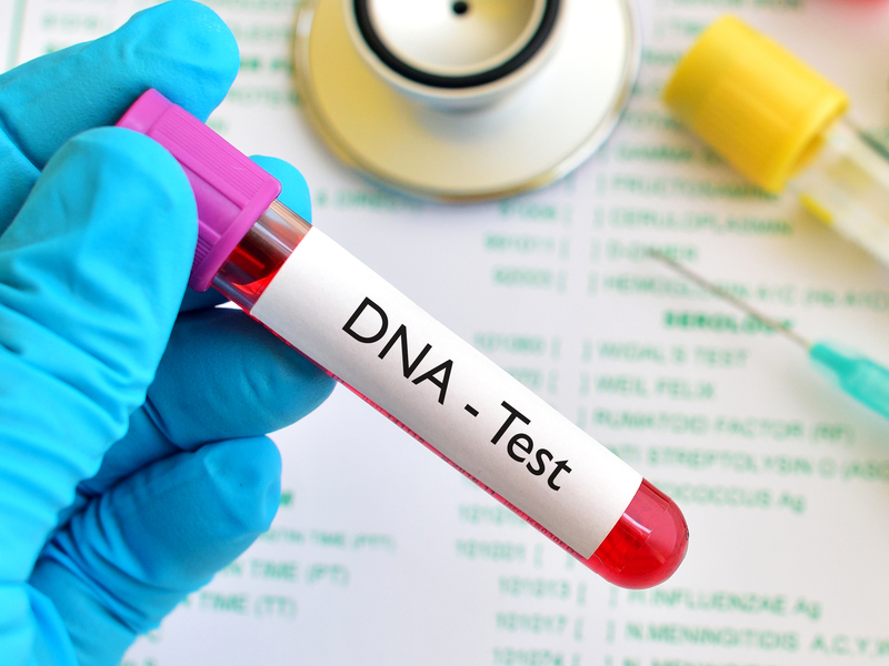 Mẫu thử bằng máu đem lại tính chính xác khá cao trong xét nghiệm ADN