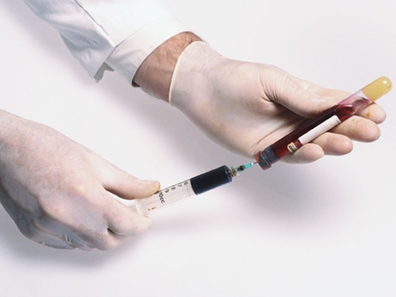 Bệnh nhân được yêu cầu xét nghiệm máu, dịch tủy xương, dịch tủy sống (nguồn: healthday.com)