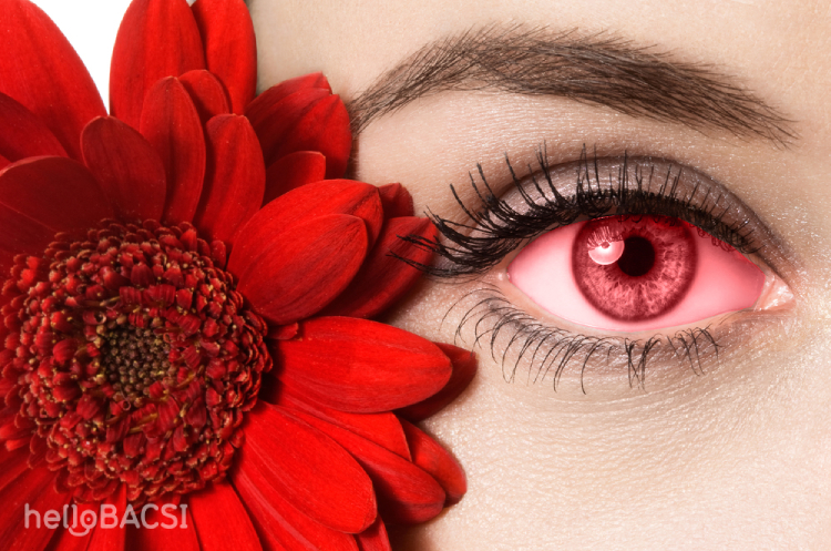 Thời gian ủ bệnh và điều trị đau mắt đỏ có thể kéo dài lên đến hơn nửa tháng