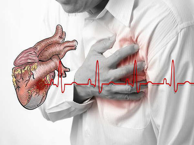 Bệnh tim do nhiều nguyên nhân khác nhau, ảnh hưởng lớn đến chất lượng cuộc sống 