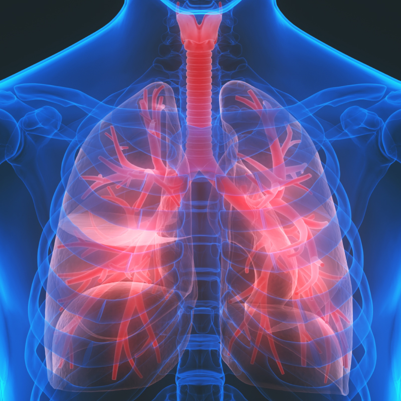 Bệnh tràn dịch màng phổi nguy hiểm đến sức khỏe