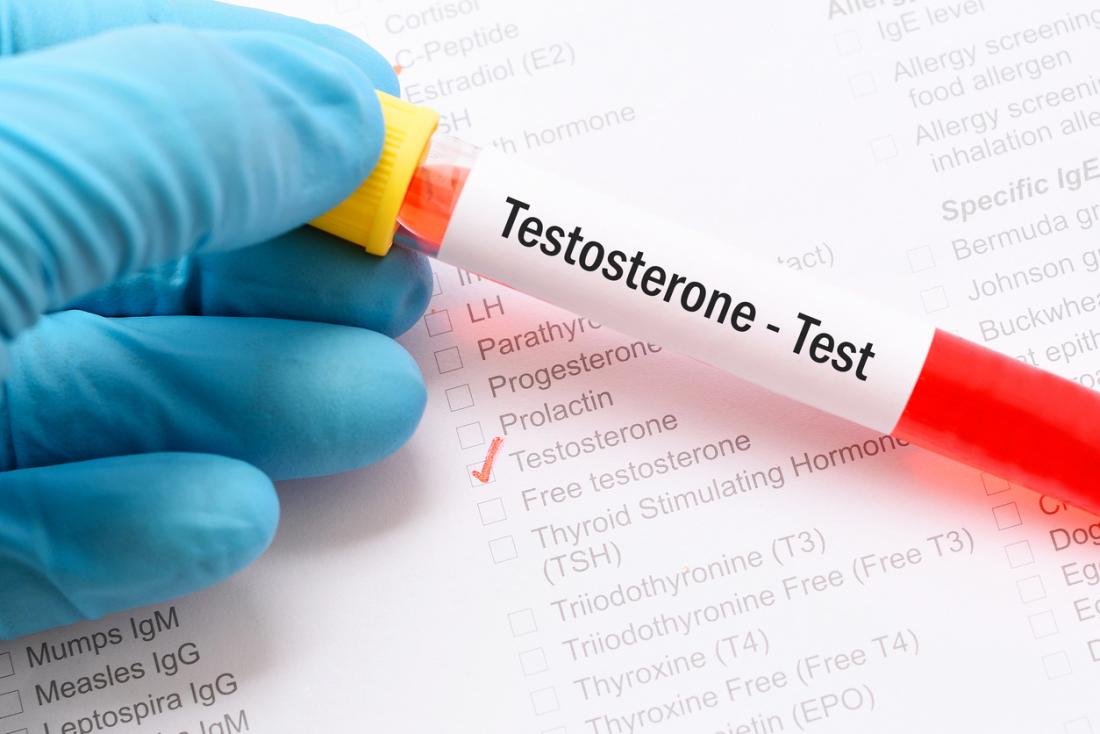 Xét nghiệm Testosterone là loại xét nghiệm quan trọng xác định khả năng tình dục, sinh sản của nam giới 
