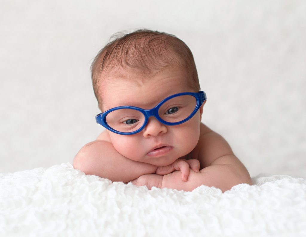 Nếu trẻ còn quá nhỏ, sau phẫu thuật mắt các bác sĩ sẽ cho đeo kính trước khi thay thủy tinh thể nhân tạo 