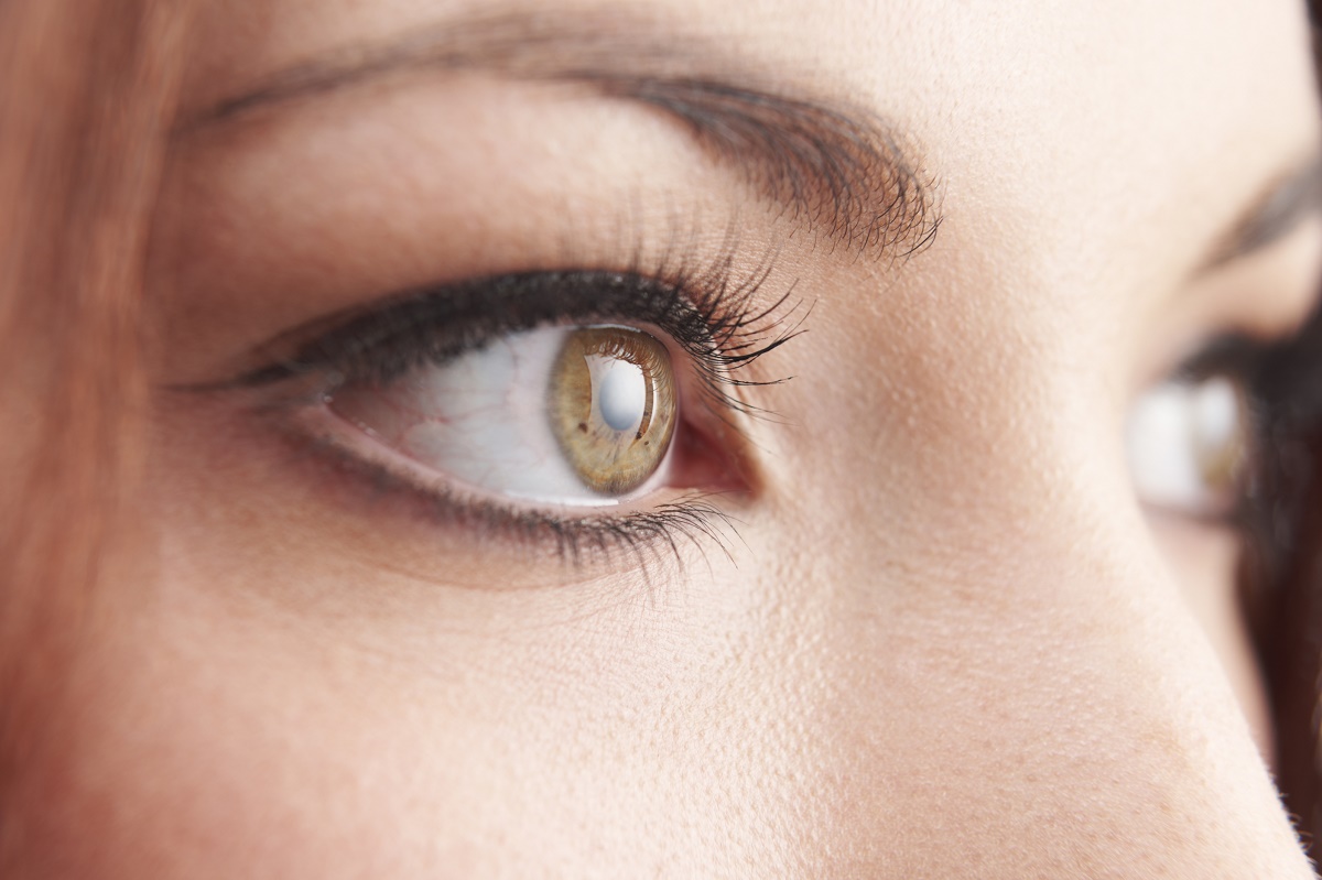 Đục thủy tinh thể khiến người bệnh suy giảm thị lực thậm chí mù lòa