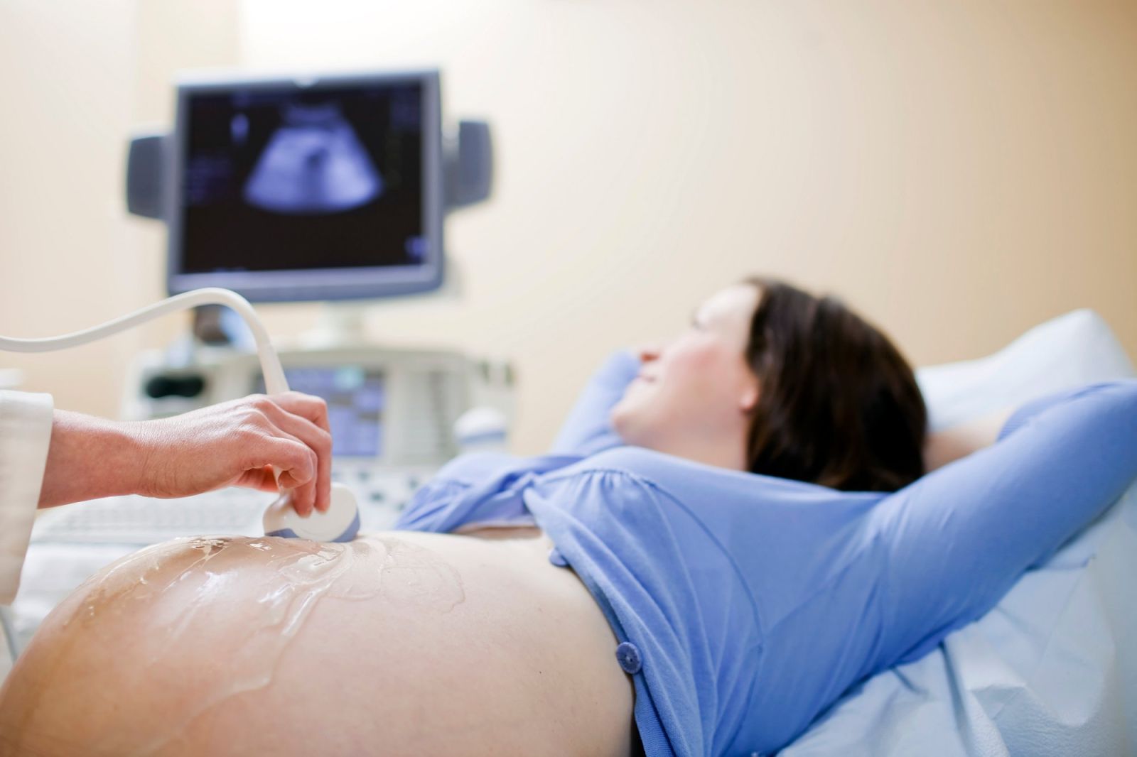 Mẹ bầu nên kiểm tra nguy cơ trẻ bị tật đầu nhỏ ngay từ khi mang thai thông qua siêu âm