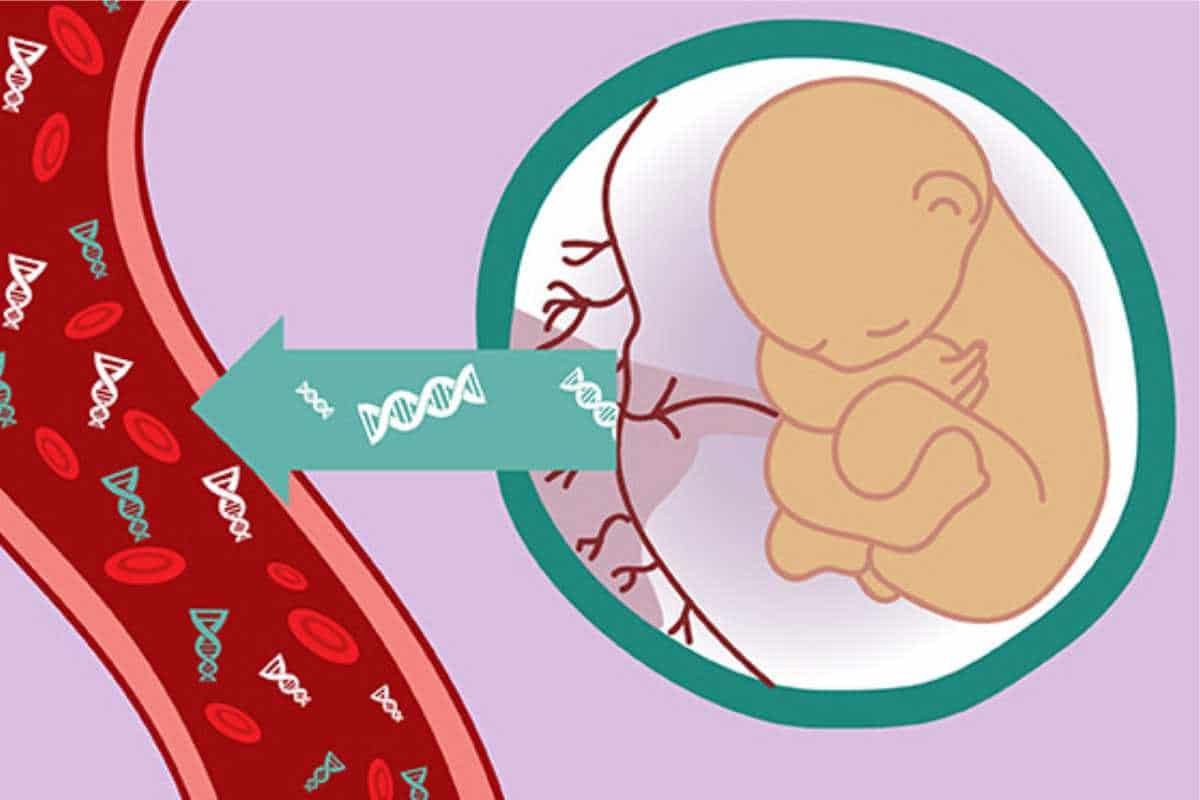 Các chỉ số trong máu thai phụ được sử dụng để xác định khả năng mắc hội chứng Edwards của bào thai 