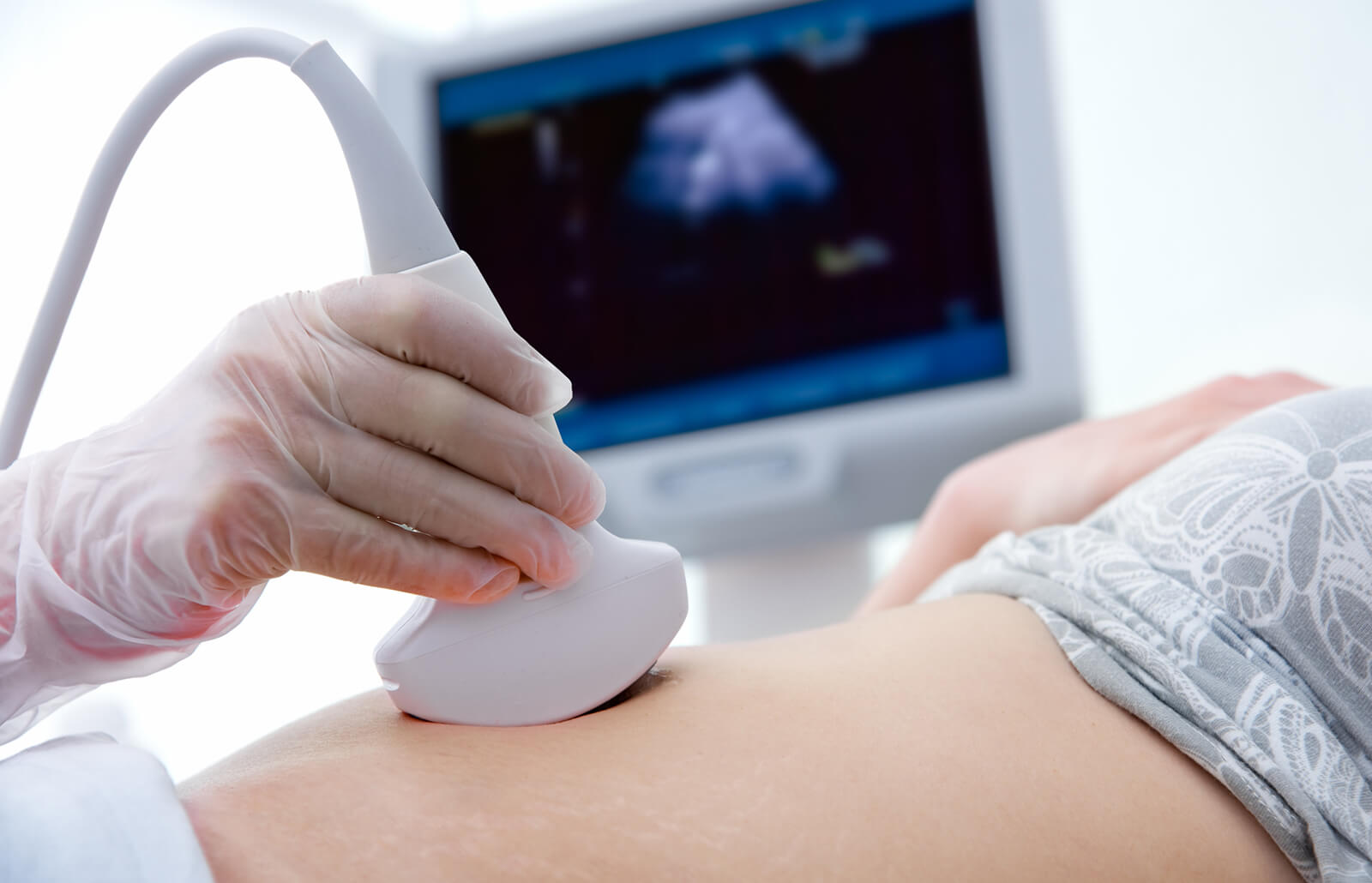 Siêu âm thai kỳ là phương pháp phổ biến để chẩn đoán hội chứng này