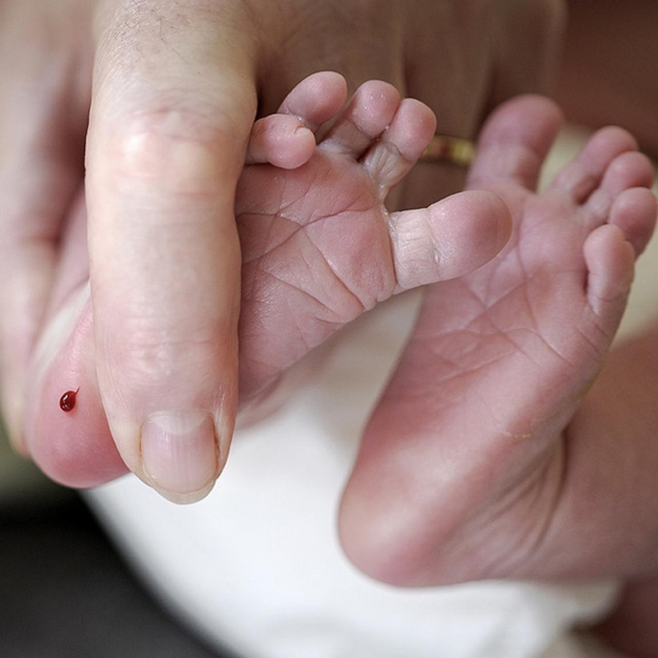 Phương pháp lấy máu gót chân trẻ sơ sinh hiện nay khá phổ biến