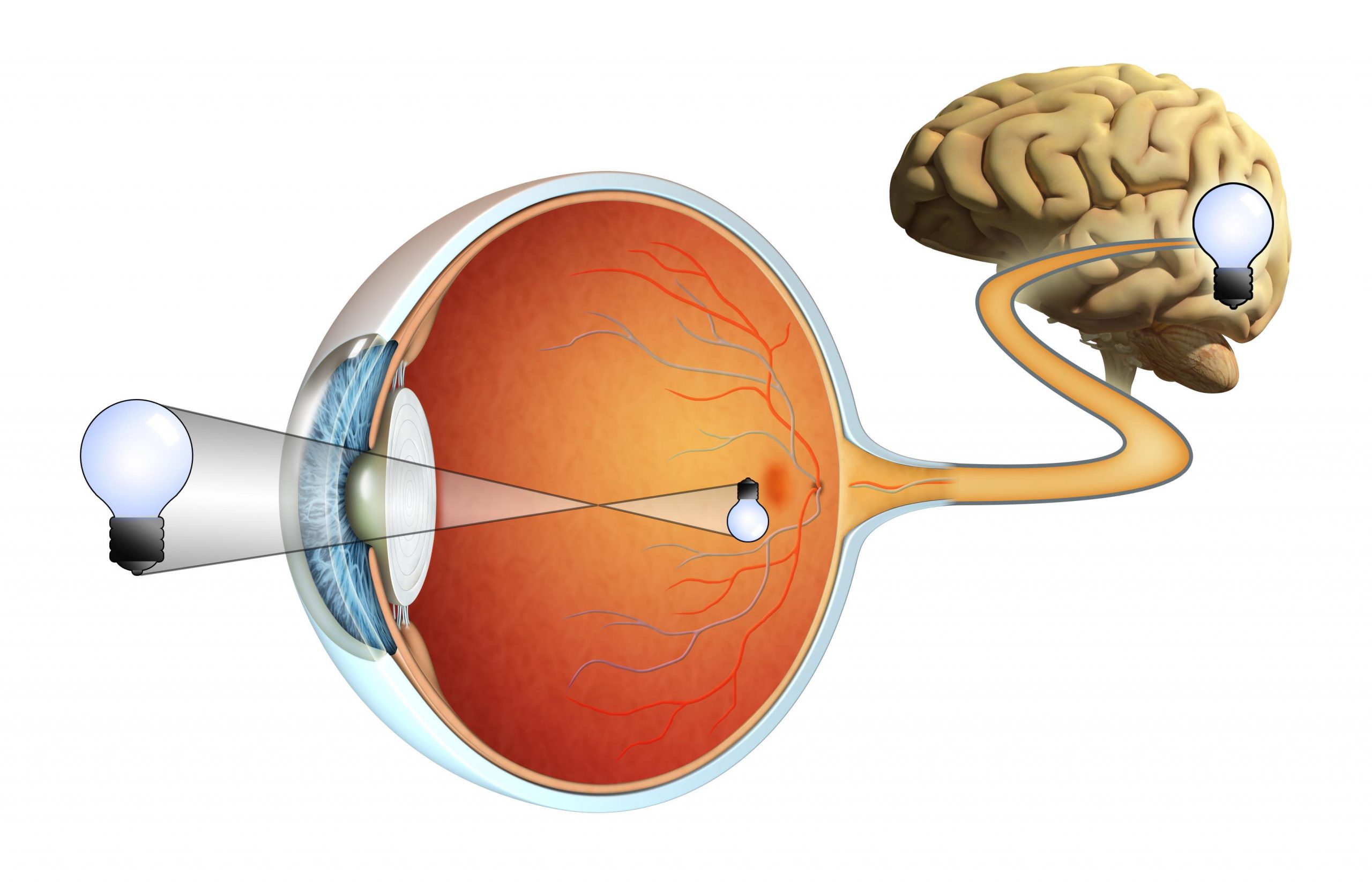 Teo dây thần kinh thị giác ảnh hưởng nhiều đến cuộc sống của người bệnh