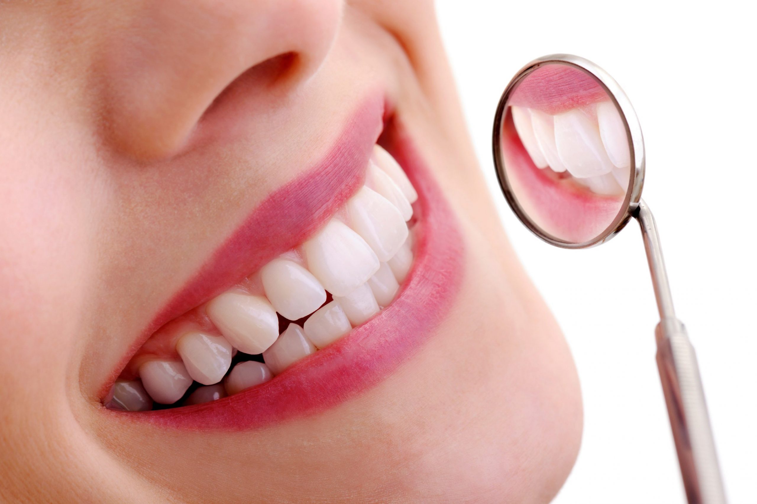 Sâu răng là bệnh lý răng miệng rất phổ biến 
