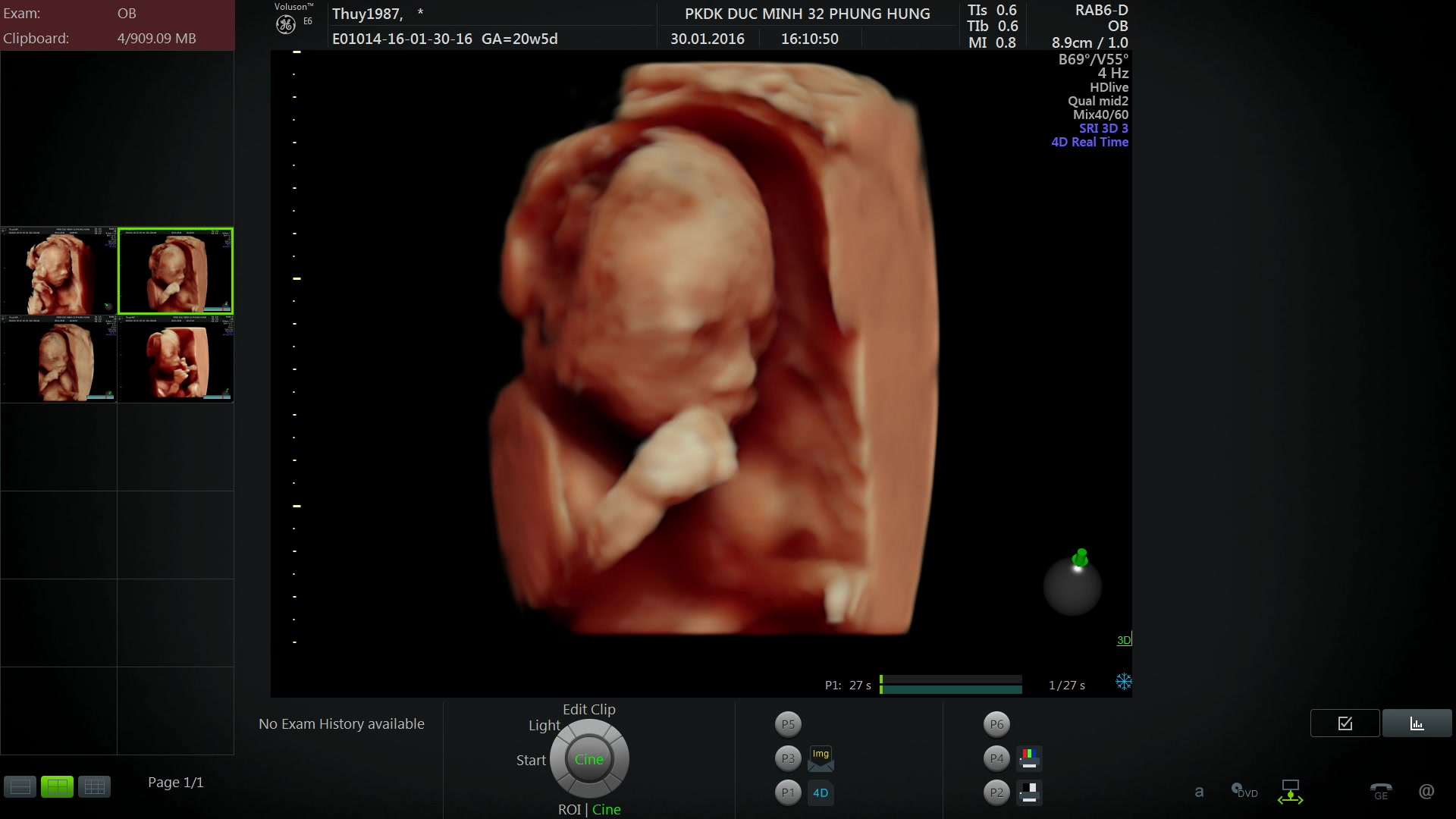 Hình ảnh thai nhi 20 tuần tuổi đã có đầy đủ các bộ phận