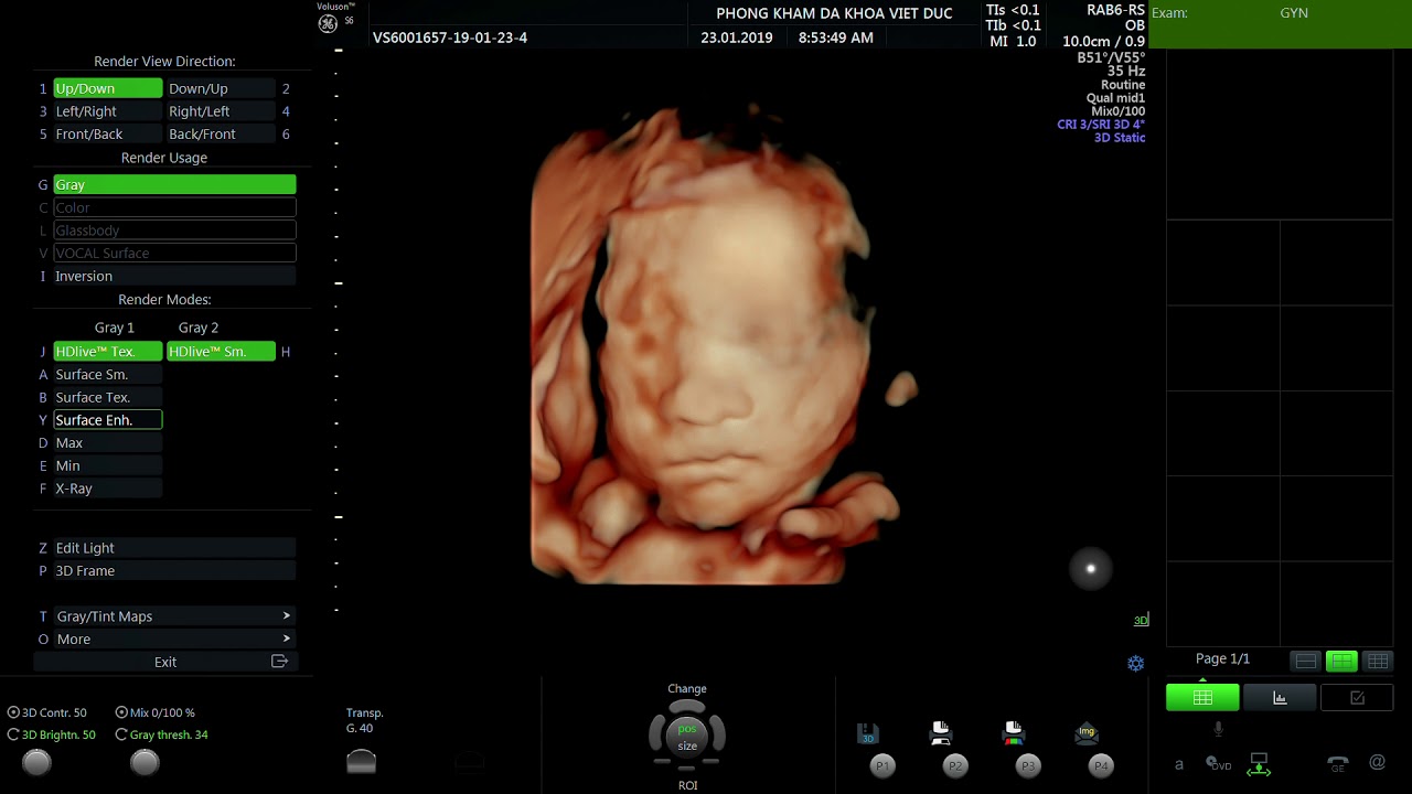Hình ảnh thai nhi 27 tuần tuổi 5 ngày