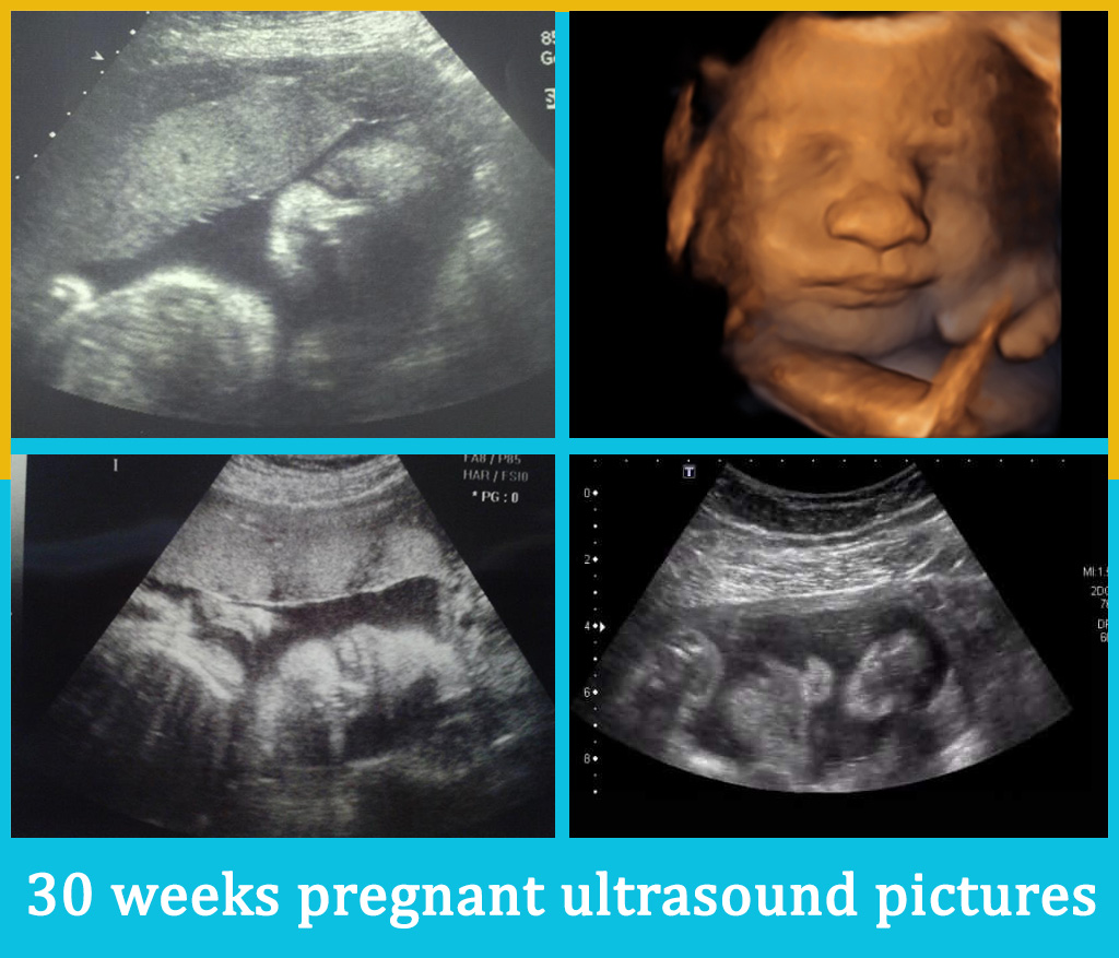 Hình ảnh siêu âm thai 30 tuần