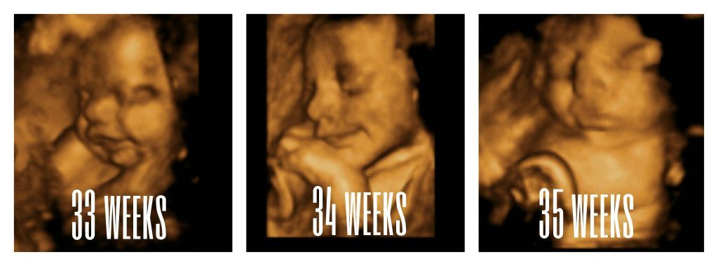 Hình ảnh thai nhi 33 tuần trong bụng mẹ