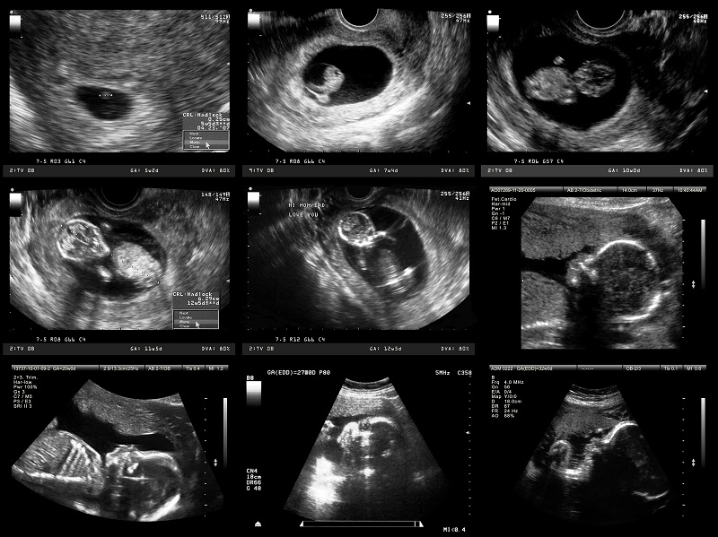 Hình ảnh sự phát triển thai nhi ở tuần thứ 10