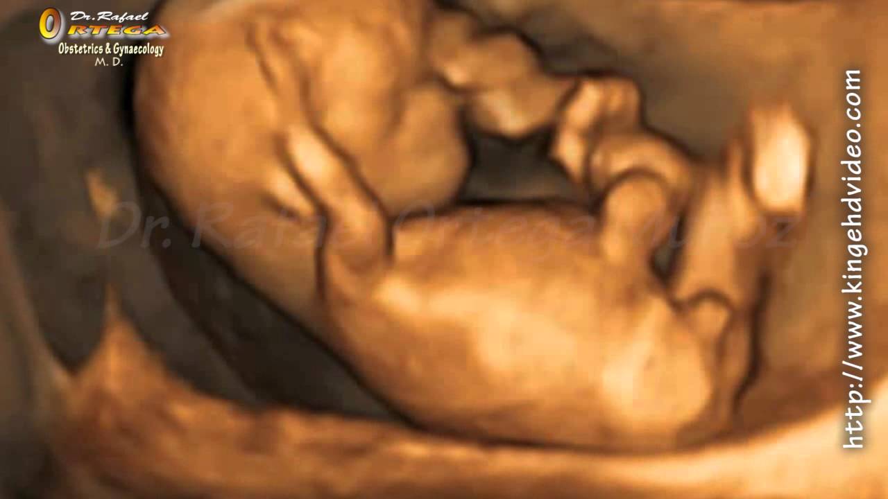 Hình ảnh siêu âm thai 11 tuần tuổi 4D