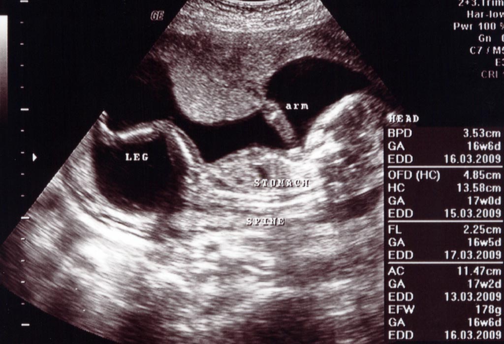 Hình ảnh thai nhi tuần thứ 16