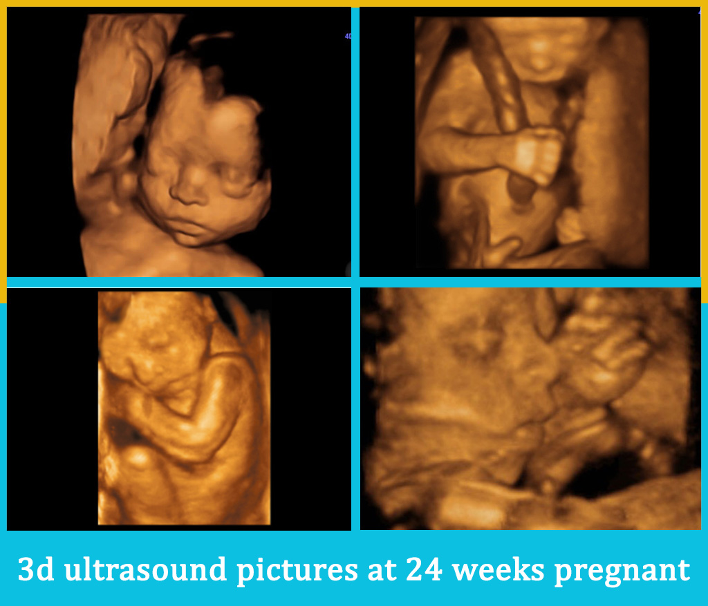 Hình ảnh thai nhi 24 tuần trong bụng mẹ