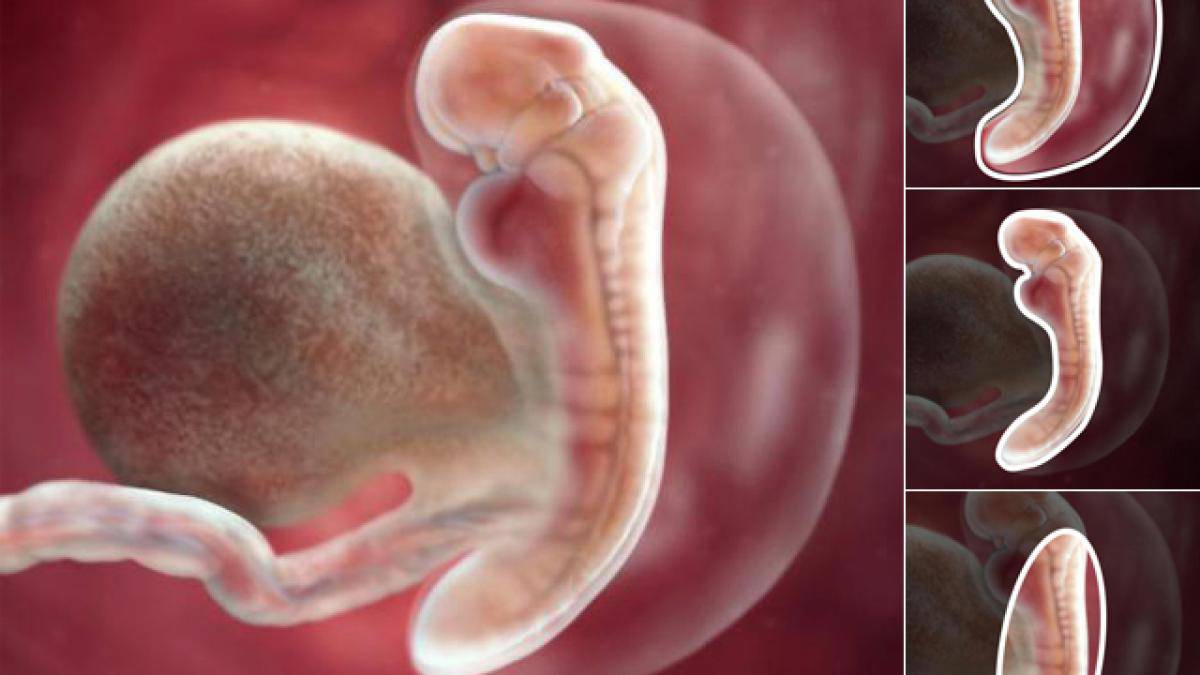 Hình ảnh siêu âm  thai nhi 5 tuần tuổi đã xuất hiện ống dẫn và tim sơ khai