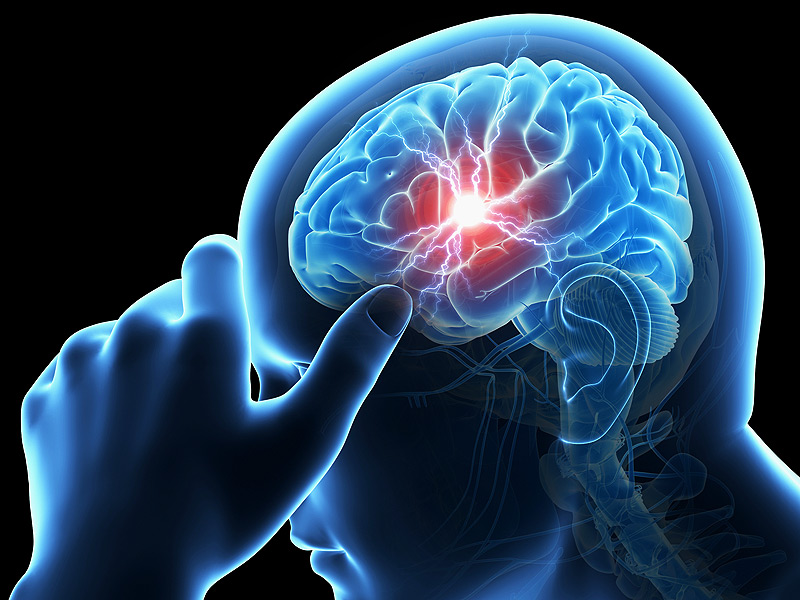 Thiểu năng tuần hoàn não có chữa khỏi được không là câu hỏi của nhiều người