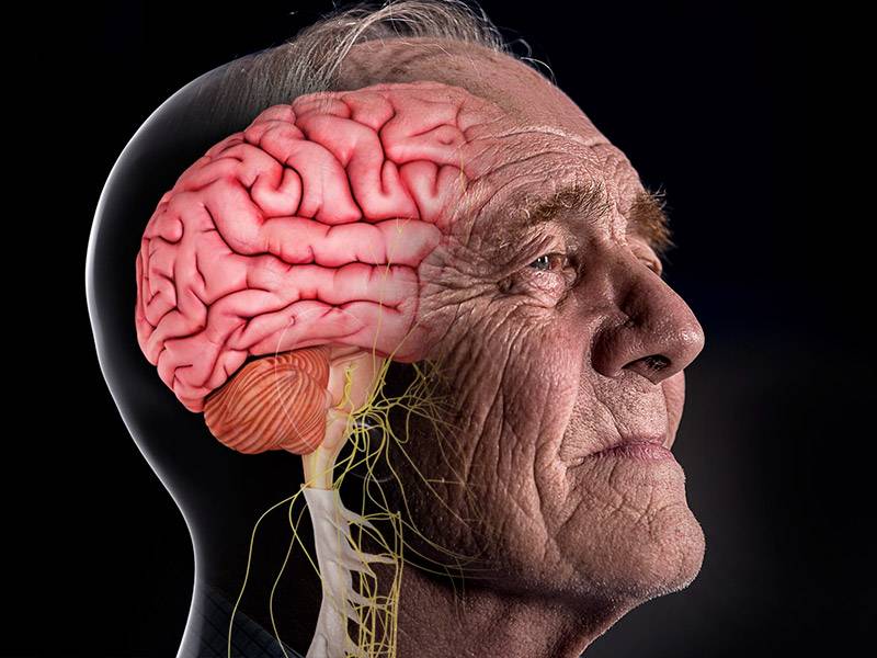 Bệnh Parkinson chữa như thế nào