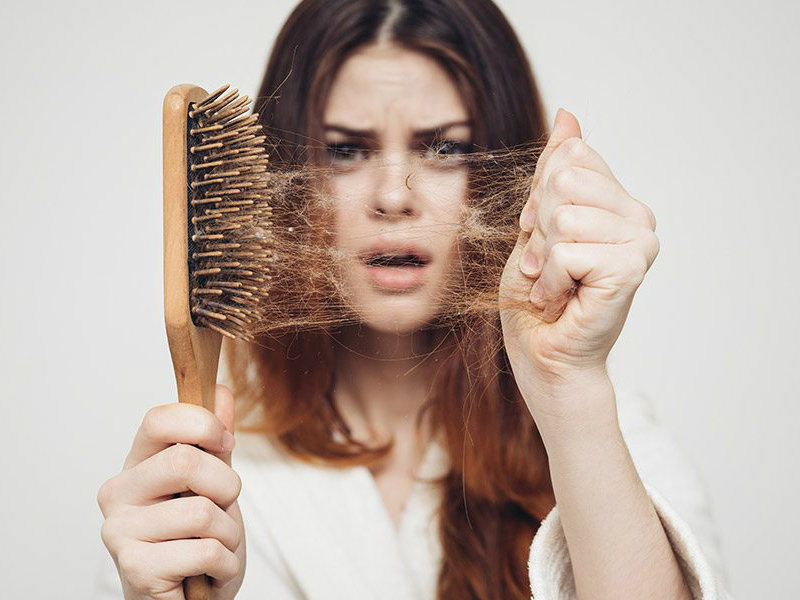 Tóc rụng nhiều cũng là triệu chứng của ung thư da đầu
