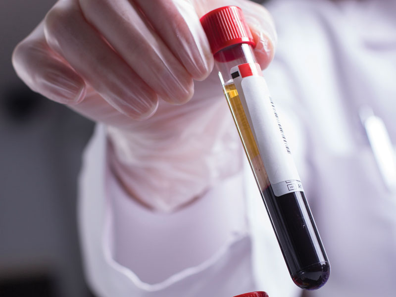 Cần xét nghiệm thường xuyên để kiểm tra ung thư máu