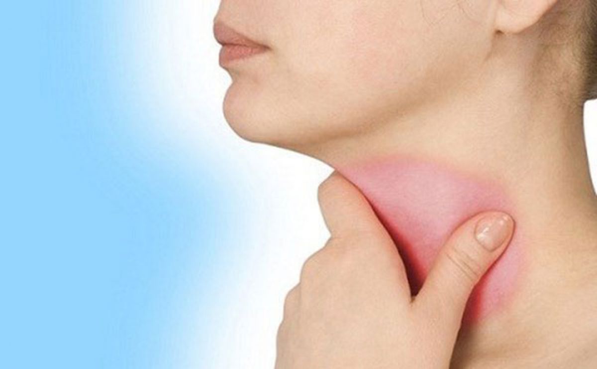 Cơn đau ở cổ, hàm hoặc tai là dấu hiệu ung thư tuyến giáp tủy 