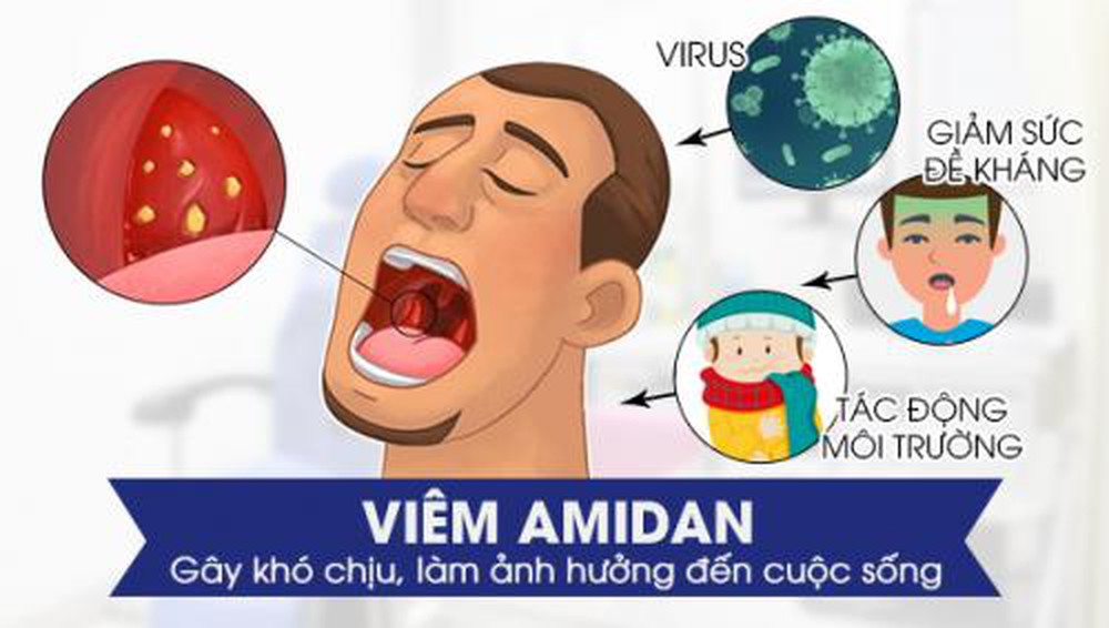 Viêm Amidan mãn tính nếu không được xử lý sớm sẽ rất nguy hiểm cho người bệnh