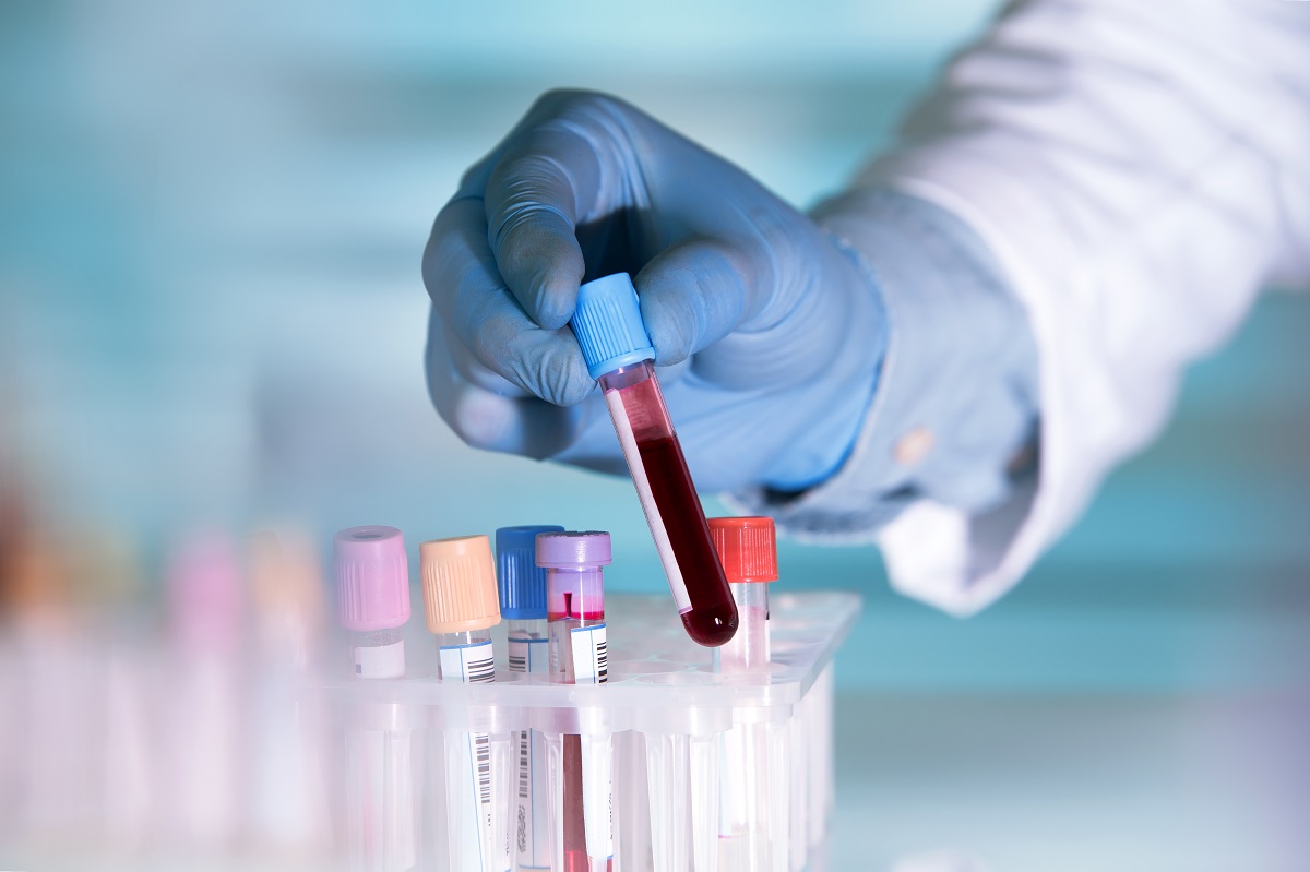 Thực hiện các xét nghiệm máu để chẩn đoán xem liệu có bị bệnh