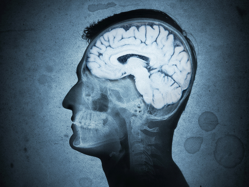 Bệnh gây nên các biến chứng về não bộ 