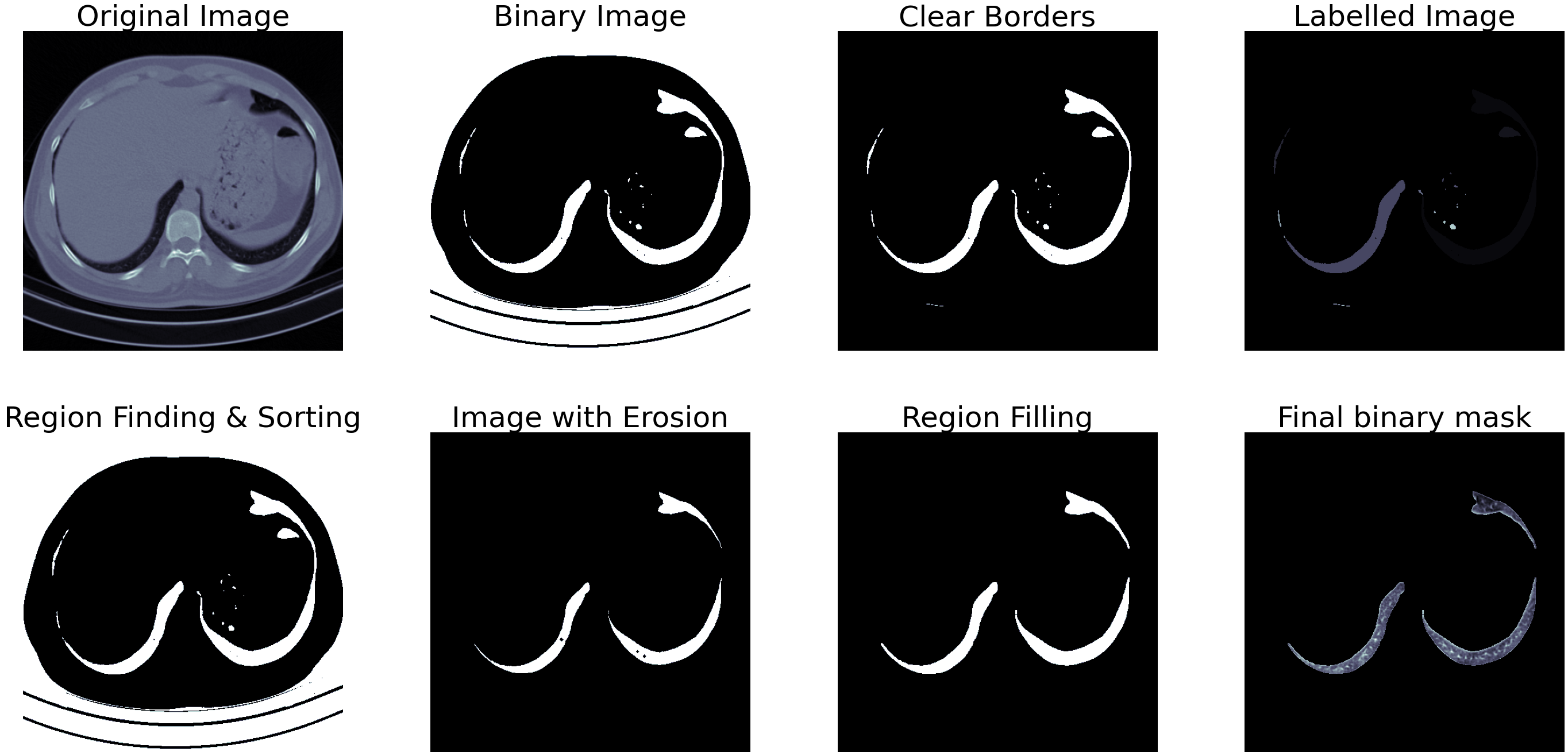 Segmentation output bad lung