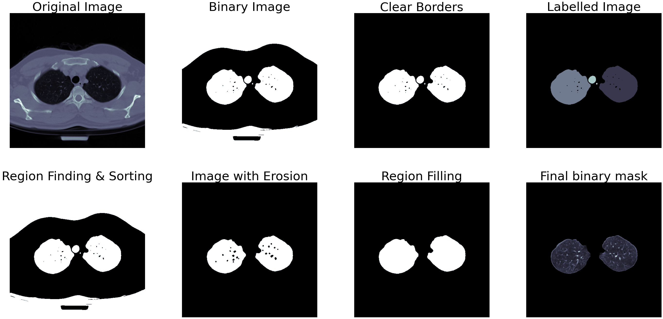 Segmentation output small lung