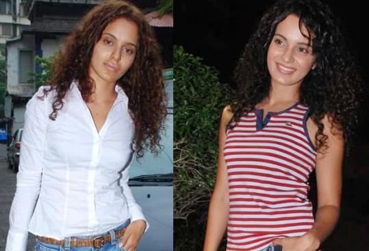 kangna-ranaut after surgery