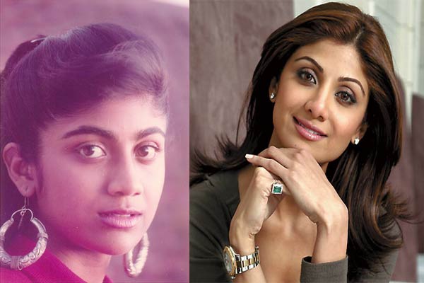 shilpa Shetty surgery