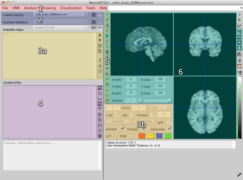 NeuroElf GUI with highlighted areas