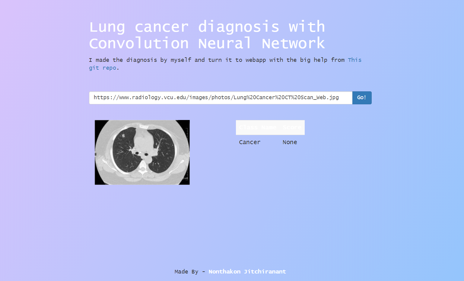 lung cancer diagnose