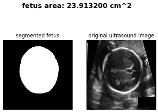 segmented image