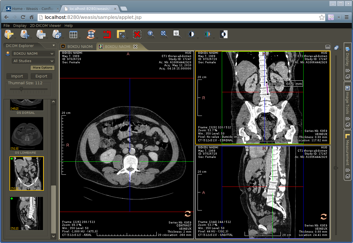 Weasis inside a web browser