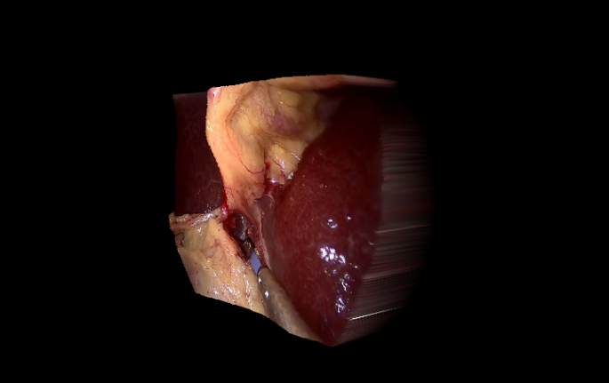 Endoscopy Depth Estimation