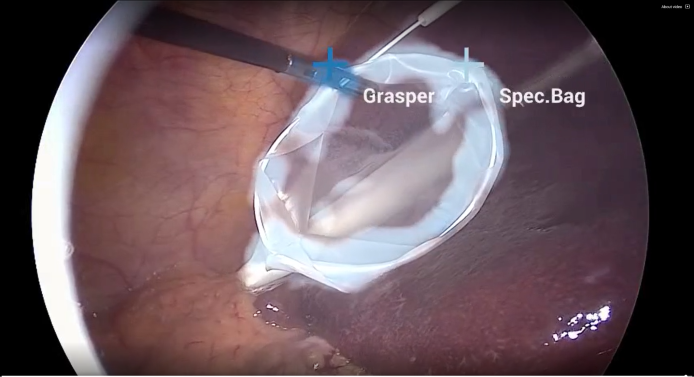 app_endoscopy