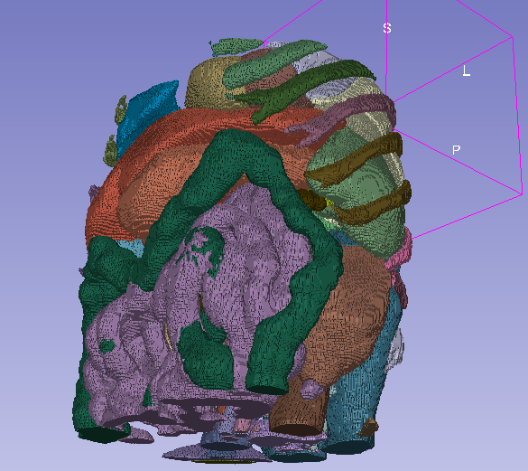 3D Volume Rendering