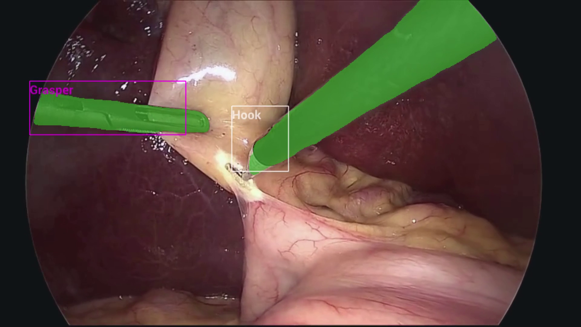 app_multiai_endoscopy